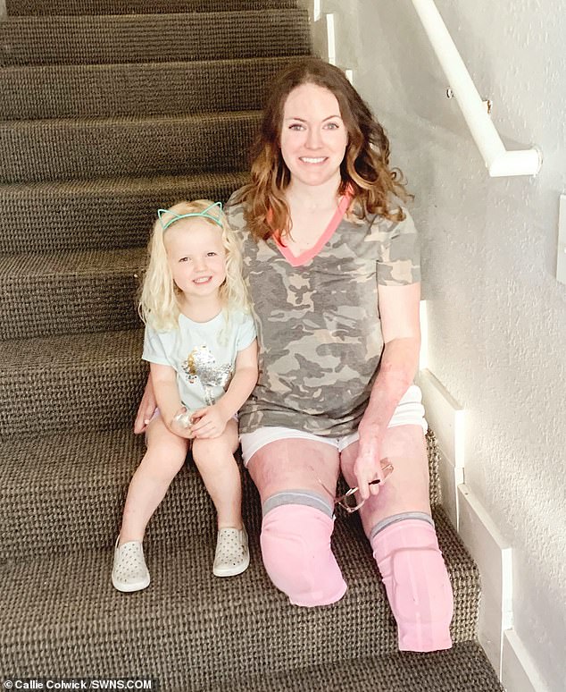 Doctors had no choice but to amputate both of Mrs Colwick's lower legs, her left thumb and forefinger because blood was unable to reach them. She is pictured at home with Kenzie