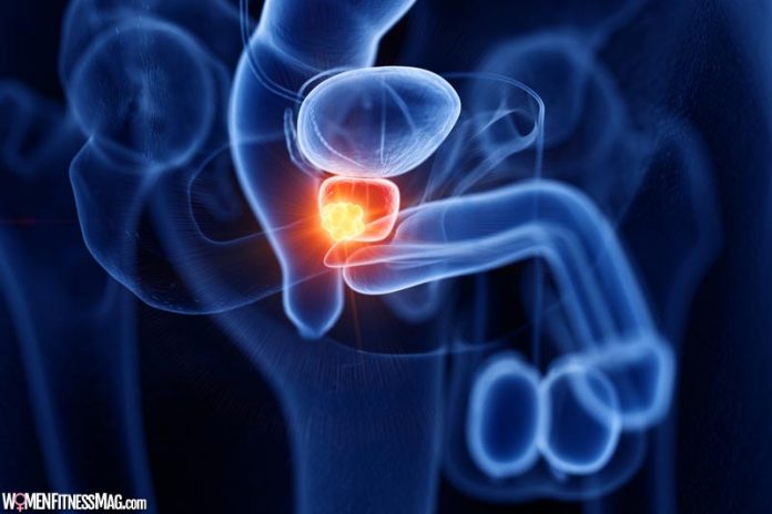 Enlarged Prostate- Treatment Options You Should Know About
